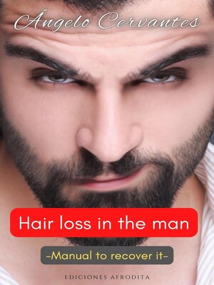 cover image of Hair Loss in the Man